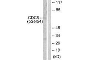 Western Blotting (WB) image for anti-Cell Division Cycle 6 Homolog (S. Cerevisiae) (CDC6) (AA 20-69), (pSer54) antibody (ABIN1531262)