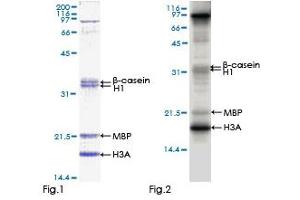 MAPKAP Kinase 5 Protein (AA 1-471) (GST tag)