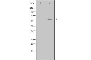 Western blot analysis of extracts of HeLa, using ZYX antibody. (ZYX Antikörper  (Internal Region))