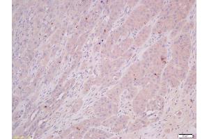 Immunohistochemistry (Paraffin-embedded Sections) (IHC (p)) image for anti-COMM Domain Containing 4 (COMMD4) (AA 1-100) antibody (ABIN872528)