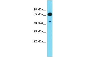Host: Rabbit  Target Name: Frmd6  Sample Tissue: Rat Stomach lysates  Antibody Dilution: 1. (FRMD6 Antikörper  (C-Term))
