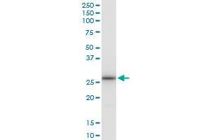 Immunoprecipitation of LRRK1 transfected lysate using anti-LRRK1 MaxPab rabbit polyclonal antibody and Protein A Magnetic Bead , and immunoblotted with LRRK1 purified MaxPab mouse polyclonal antibody (B01P) . (LRRK1 Antikörper  (AA 1-261))