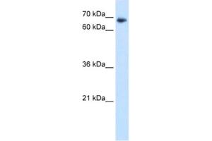 Western Blotting (WB) image for anti-TAF6 RNA Polymerase II, TATA Box Binding Protein (TBP)-Associated Factor, 80kDa (TAF6) antibody (ABIN2461025)