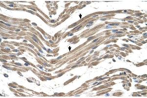 Human Muscle (C1QB Antikörper  (C-Term))