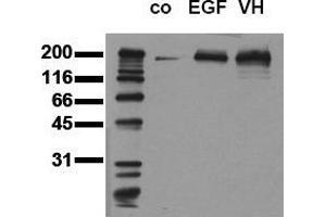 Western Blotting (WB) image for anti-Epidermal Growth Factor Receptor (EGFR) (pTyr1173) antibody (ABIN126779) (EGFR Antikörper  (pTyr1173))