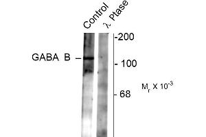 Western blots of rat synaptic membrane showing specific immunolabeling of the ~102 k GABAB R2 protein phosphorylated at Ser783 (control).