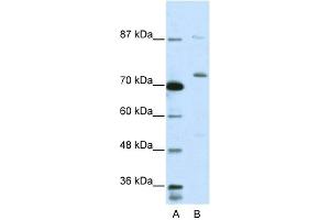 WB Suggested Anti-EXOSC10 Antibody Titration:  5. (EXOSC10 Antikörper  (C-Term))