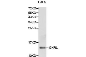 Western Blotting (WB) image for anti-Ghrelin (GHRL) (AA 1-117) antibody (ABIN6217352) (Ghrelin Antikörper  (AA 1-117))