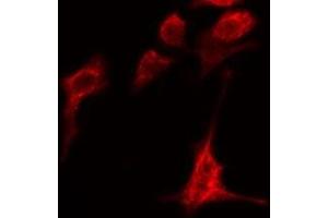 Immunofluorescence (fixed cells) (IF/ICC) image for anti-ADAM Metallopeptidase with Thrombospondin Type 1 Motif, 1 (ADAMTS1) (Internal Region) antibody (ABIN6259779)