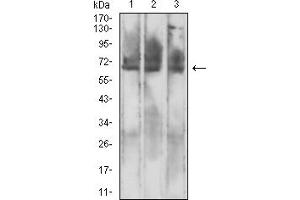 Western Blotting (WB) image for anti-Mesothelin (MSLN) (AA 37-286) antibody (ABIN7193453)