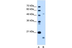 Western Blotting (WB) image for anti-Zinc Metalloproteinase, Ste24 (Zmpste24) antibody (ABIN2462996) (ZMPSTE24 Antikörper)