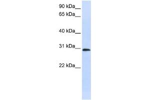 WB Suggested Anti-C6orf21 Antibody Titration:  0. (LY6G6F Antikörper  (Middle Region))