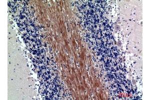 Immunohistochemical analysis of paraffin-embedded human-brain, antibody was diluted at 1:200 (SIRPA/SIRPB1 (Internal Region) Antikörper)