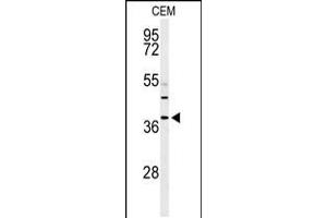 Western blot analysis of RNASEH2B Antibody in CEM cell line lysates (35ug/lane) (RNASEH2B Antikörper  (AA 130-157))