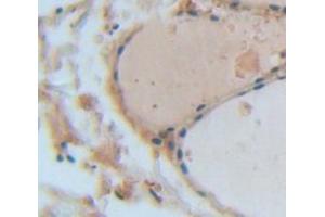 Immunohistochemistry (IHC) image for anti-Angiogenic Factor with G Patch and FHA Domains 1 (AGGF1) (AA 470-704) antibody (ABIN1866580)