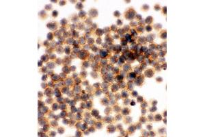 Immunohistochemistry (IHC) image for anti-Amyloid beta (A4) Precursor Protein-Binding, Family B, Member 1 Interacting Protein (APBB1IP) (AA 647-666), (C-Term) antibody (ABIN3044029)