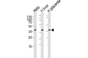 Western blot analysis of lysates from Hela cell line , human liver and placenta tissue lysate(from left to right), using OLR1 Antibody at 1:1000 at each lane. (OLR1 Antikörper  (AA 64-92))
