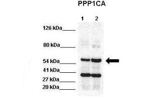 WB Suggested Anti-PPP1CA Antibody  Positive Control: Lane 1:441 µg HEK293 lysate Lane 2: 041 µg H1299 lysate Primary Antibody Dilution: 1:0000Secondary Antibody: Goat anti-rabbit-HRP Secondry  Antibody Dilution: 1:0000Submitted by: Jose Luis Rosa, Universitat de Barcelona
