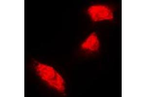 Immunofluorescent analysis of Cytokeratin 18 staining in A431 cells. (Cytokeratin 18 Antikörper  (C-Term))