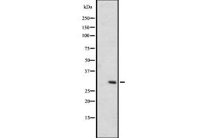 Western blot analysis of OR6C75 expression in A431 whole cell lysate ,The lane on the left is treated with the antigen-specific peptide. (OR6C75 Antikörper)