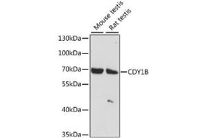 Western blot analysis of extracts of various cell lines, using CDY1B antibody. (CDY1B Antikörper)