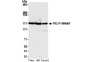 Western Blotting (WB) image for anti-Proline-, Glutamic Acid- and Leucine-Rich Protein 1 (PELP1) (AA 1000-1050) antibody (ABIN7453550)
