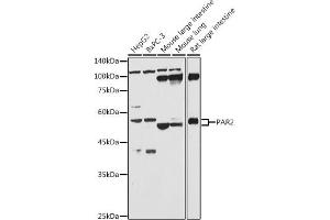Western blot analysis of extracts of various cell lines, using P antibody (ABIN6132104, ABIN6140406, ABIN6140407 and ABIN6224794) at 1:1000 dilution. (F2RL1 Antikörper  (AA 318-397))