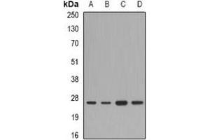 Western blot analysis of FAM173B expression in A549 (A), mouse liver (B), mouse heart (C), rat brain (D) whole cell lysates. (FAM173B Antikörper)
