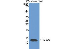 Western Blotting (WB) image for anti-Cystatin B (Stefin B) (CSTB) (AA 2-98) antibody (ABIN1077972) (CSTB Antikörper  (AA 2-98))