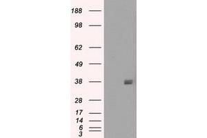 Image no. 6 for anti-Fc gamma RII (CD32) antibody (ABIN1497256) (Fc gamma RII (CD32) Antikörper)