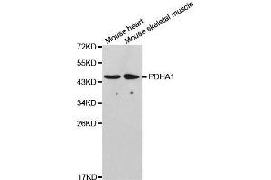 Western blot analysis of extracts of various cell lines, using PDHA1 antibody. (PDHA1 Antikörper  (AA 30-390))