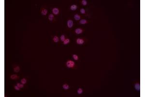ABIN6276553 staining Hela cells by IF/ICC. (DUSP6 Antikörper  (Internal Region))