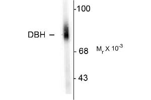 Western blots of human adrenal medulla lysate showing specific immunolabeling of the ~75k DBH protein. (DBH Antikörper  (N-Term))