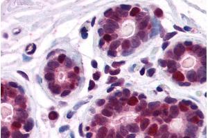 Immunohistochemistry (IHC) image for anti-DEAD (Asp-Glu-Ala-Asp) Box Polypeptide 5 (DDX5) (C-Term) antibody (ABIN185199)
