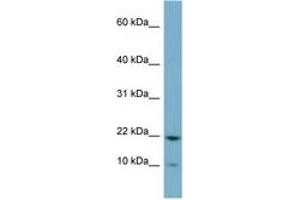 Image no. 1 for anti-Desumoylating Isopeptidase 1b (DESI1B) (C-Term) antibody (ABIN6741787) (DESI1 / PPPDE2 Antikörper  (C-Term))