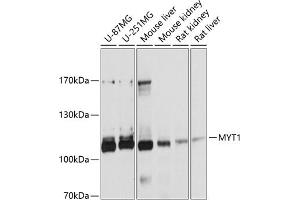 Western blot analysis of extracts of various cell lines, using MYT1 antibody (ABIN6129057, ABIN6144304, ABIN6144305 and ABIN6215004) at 1:1000 dilution. (MYT1 Antikörper  (AA 650-820))