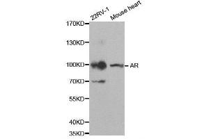 Western blot analysis of extracts of various cell lines, using AR antibody. (Androgen Receptor Antikörper)