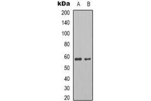 Western blot analysis of Pyruvate Kinase expression in MCF7 (A), HepG2 (B) whole cell lysates. (Pyruvate Kinase Antikörper)