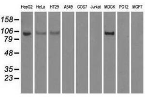 Image no. 3 for anti-Hexokinase 2 (HK2) antibody (ABIN1498647)