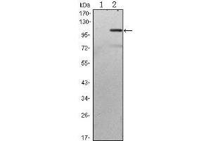 Western Blot showing TAB2 antibody used against HEK293 (1) and TAB2 (AA: 1-300)-hIgGFc transfected HEK293 (2) cell lysate. (TAB2 Antikörper)