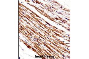 Immunohistochemistry (Formalin/PFA-fixed paraffin-embedded sections) of human heart tissue with PLA2G5 polyclonal antibody  followed by peroxidase conjugation of the secondary antibody and DAB staining. (PLA2G5 Antikörper  (AA 103-132))