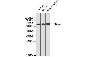 Western blot analysis of extracts of various cell lines using PTPN6 Polyclonal Antibody at dilution of 1:1000. (SHP1 Antikörper)