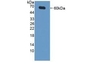 Detection of Recombinant XIAP, Human using Polyclonal Antibody to X-linked Inhibitor Of Apoptosis Protein (XIAP) (XIAP Antikörper  (AA 1-497))