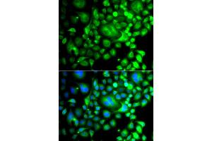 Immunofluorescence analysis of A549 cells using SNX3 antibody (ABIN6290935). (Sorting Nexin 3 Antikörper)