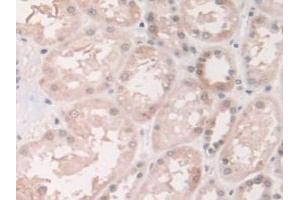 IHC-P analysis of Human Kidney Tissue, with DAB staining. (Grancalcin Antikörper  (AA 1-139))