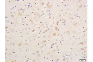 Formalin-fixed and paraffin embedded rat brain labeled with Anti phospho-B-Raf (Ser365) Polyclonal Antibody, Unconjugated (ABIN682888) at 1:200 followed by conjugation to the secondary antibody and DAB staining (SNRPE Antikörper  (pSer365))