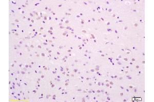 Immunohistochemistry (IHC) image for anti-SHC (Src Homology 2 Domain Containing) Transforming Protein 1 (SHC1) (pSer36) antibody (ABIN745913)