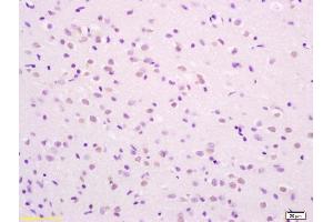 Formalin-fixed and paraffin embedded rat brain labeled with Rabbit Anti phospho-SHC(Ser36) Polyclonal Antibody, Unconjugated (ABIN745913) at 1:200 followed by conjugation to the secondary antibody and DAB staining (SHC1 Antikörper  (pSer36))