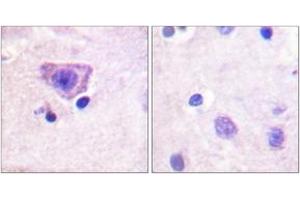 Immunohistochemistry analysis of paraffin-embedded human brain, using RyR2 (Phospho-Ser2808) Antibody. (RYR2 Antikörper  (pSer2808))