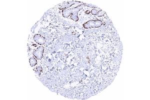 Breast Caldesmon h staining of myoepithelial cells Caldesmon h immunohistochemistry (Rekombinanter Caldesmon Antikörper)